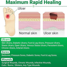 Load image into Gallery viewer, LMNOOP® Skin Ulcer Healing Ointment, for Foot & Leg Ulcers, Sores, Varicose Ulcers, Stasis Ulcers, Bedsores, Cuts, Burns, Skin Infections, Natural Ingredients Deep Wound Healing Ointment